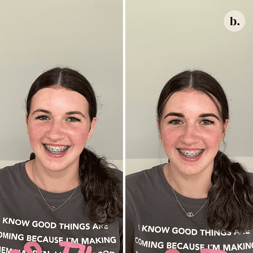 Anne before & after Browstore Limmen
